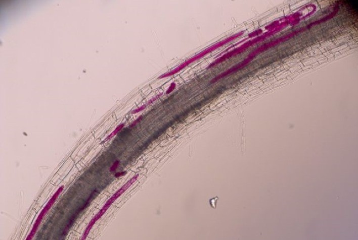 Nematoides são microscópios, mas causam prejuízo de R$ 35 bi por ano ao agro brasileiro