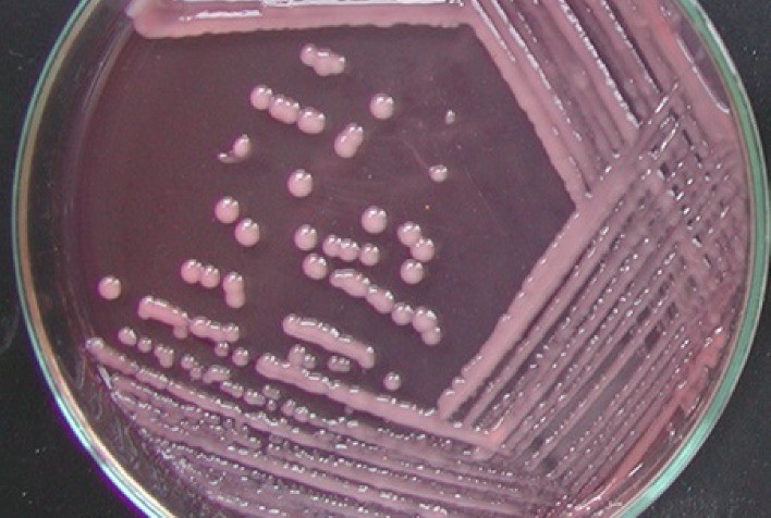 Reunião Relare Debate Inoculantes Microbianos e Seu Potencial no Brasil