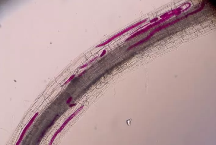 Nematoides são microscópios, mas causam prejuízo de R$ 35 bi por ano ao agro brasileiro