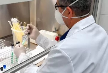 Novo método da Embrapa reduz custos e amplia acesso ao diagnóstico da tuberculose em humanos e animais